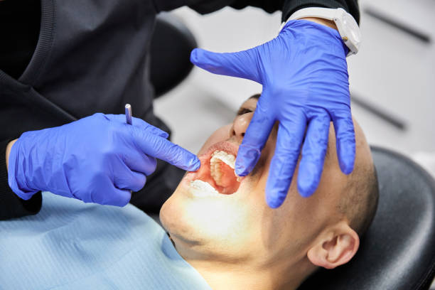 Best Cracked Tooth Emergency Dentist  in Manche Village, CA